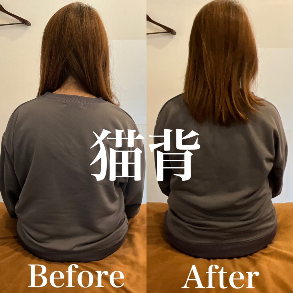 猫背