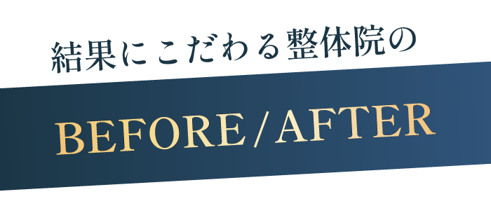 整体BEFORE/AFTERE